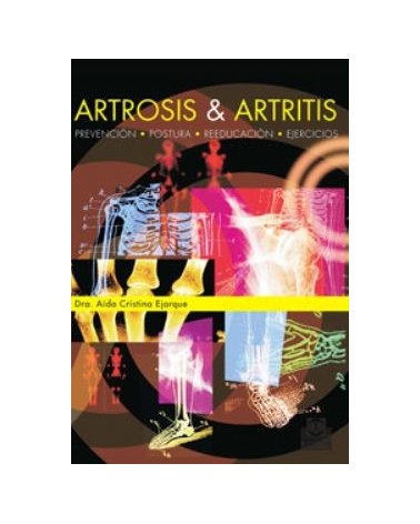 Artrosis Y Artritis