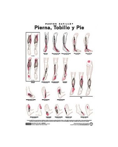 Lamina de pared Puntos Gatillo Pierna Tobillo Y Pie