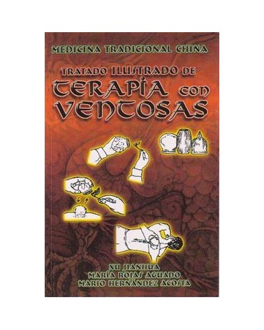 Tratado Ilustrado De Terapia Con Ventosas