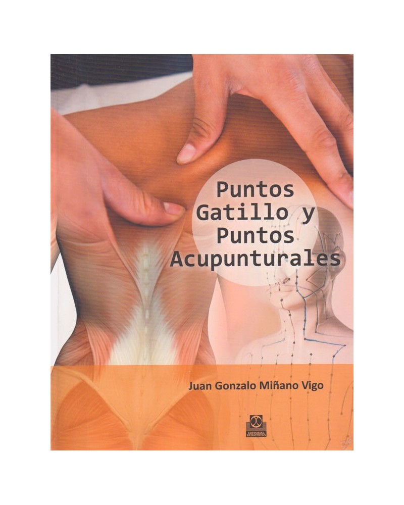 Puntos Gatillo y Puntos Acupunturales