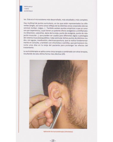 Puntos Gatillo y Puntos Acupunturales