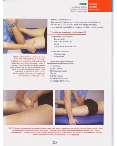 Puntos Gatillo y Puntos Acupunturales