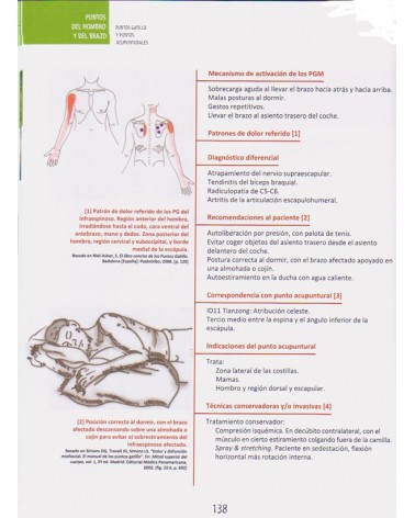 Puntos Gatillo y Puntos Acupunturales