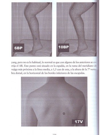 Acupuntura avanzada no invasiva sin agujas