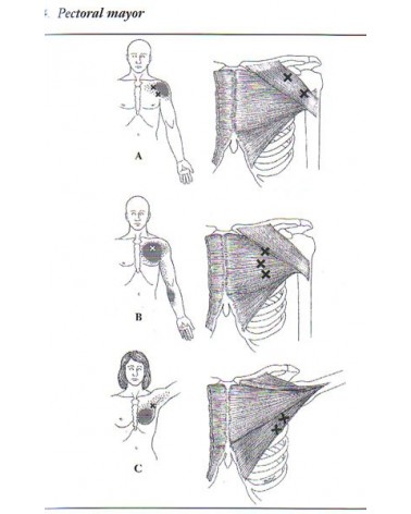 Tratado de osteopatía Tomo 4 (Francisco Fajardo Ruiz) Ed. Dilema ISBN  9788498273663