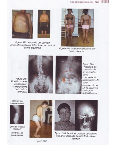 LAS CADENAS FISIOLÓGICAS - Tomo I - Fundamentos del método