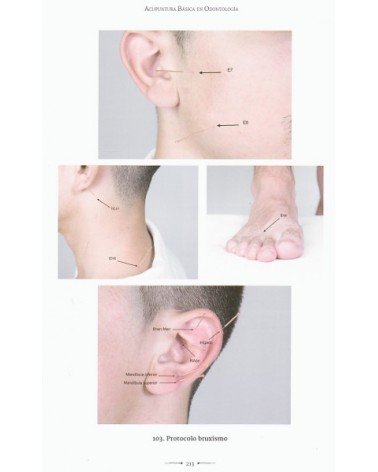 Acupuntura básica en odontología, por Dr. Vicente Vicente Calderón / Ibán Jesús Muñoz Gómez. Editorial Edaf