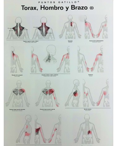 Lámina de pared Puntos Gatillo: Tórax, Hombro y Brazo (I)