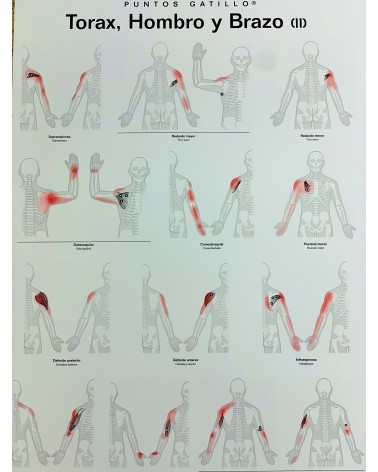 Lámina de pared Puntos Gatillo: Tórax, Hombro y Brazo (II)