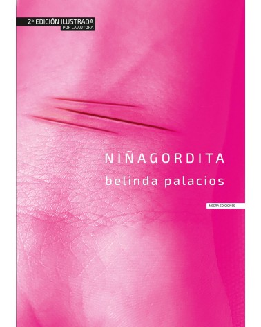 Niñagordita (edición ilustrada)