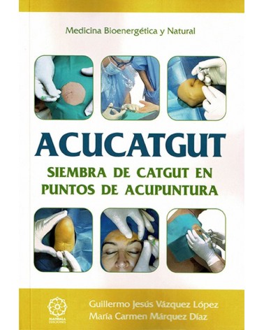 Acucatgut