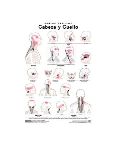Lamina de pared Puntos Gatillo Cabeza Y Cuello