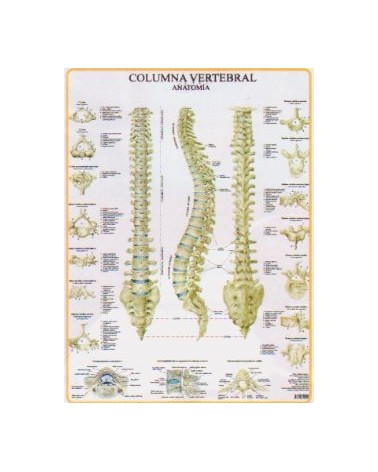 Lamina De Pared Columna Vertebral